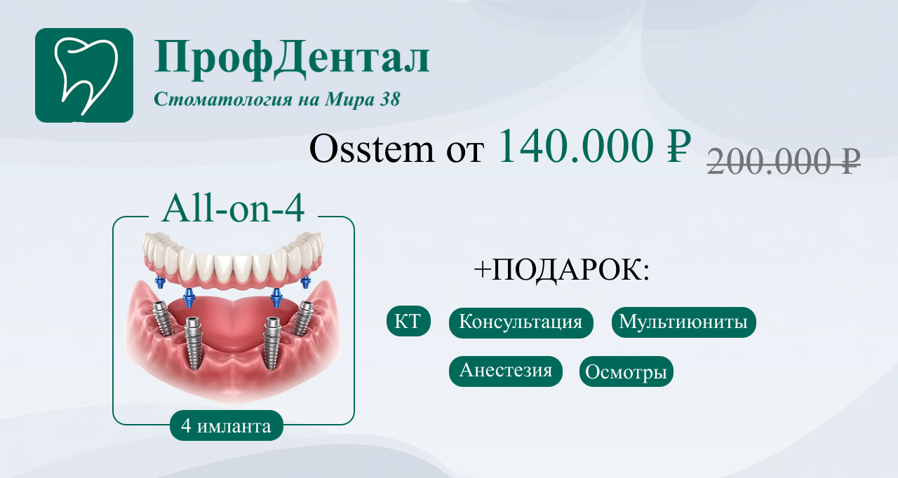 Все на 4