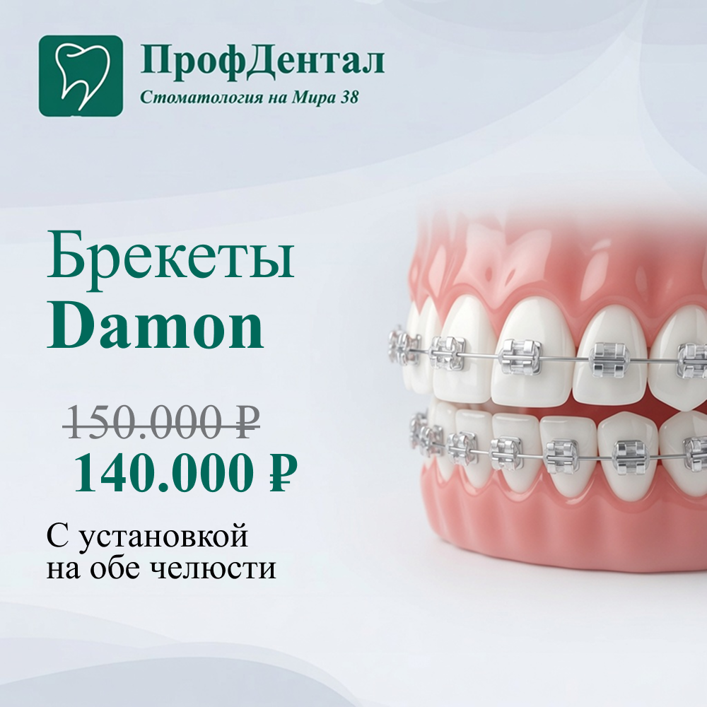 Брекеты